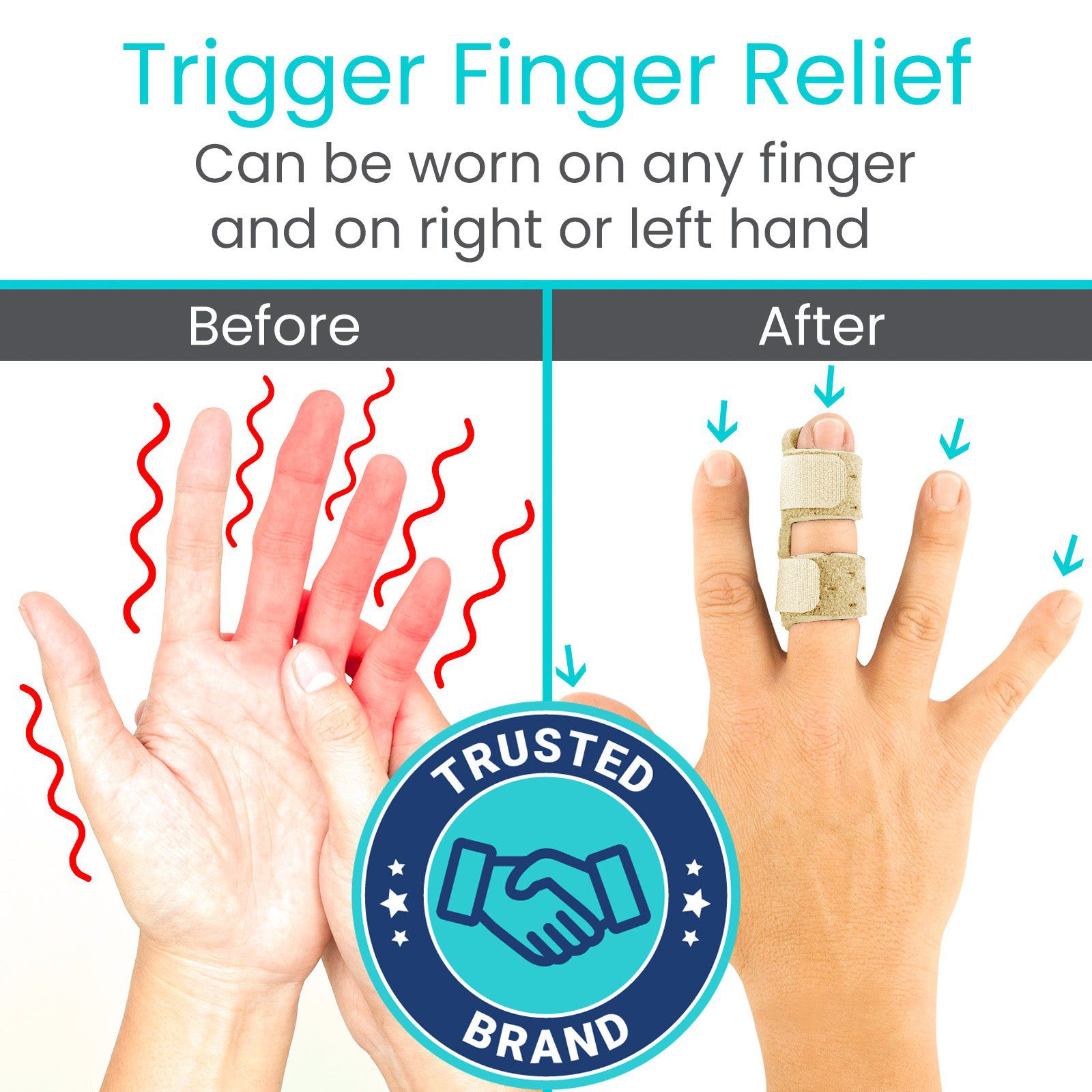 Universal Finger Splint