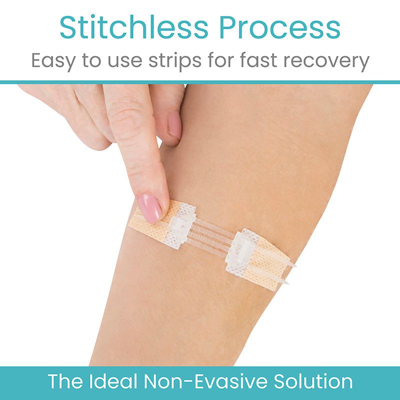Wound Closure Kit