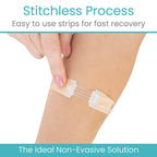 Wound Closure Kit